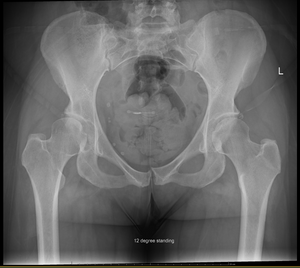 Give it to me straight, Doc. Will I ever peg again?